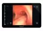 Monitor endoscopico portatile Ambu aView 2 Advance