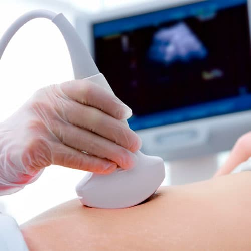 Stetoscopio Fetale per il Rilevamento del Battito Cardiaco del Bambino,  Monitoraggio dello Stetoscopio del Cuore Fetale Morbido in Lega di  Alluminio